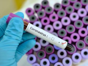 11254852 457 1 300x225 - ساخت داروی ضد ویروس کرونا در چین | داروی مِرس و ابولا بهترین درمان ضد کرونا